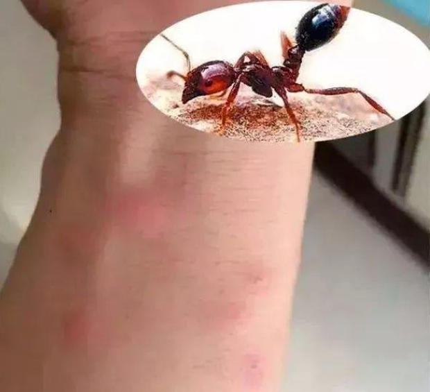 红火蚁出没,已有多人被咬伤!