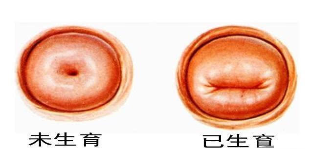 宫颈为何老爱生病?女性最该了解宫颈的5个知识点