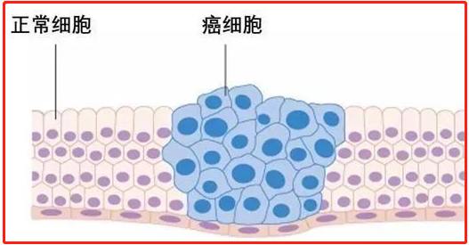 无限增殖 在适宜条件下,癌细胞能无限增殖,成为"不死"的永生细胞.