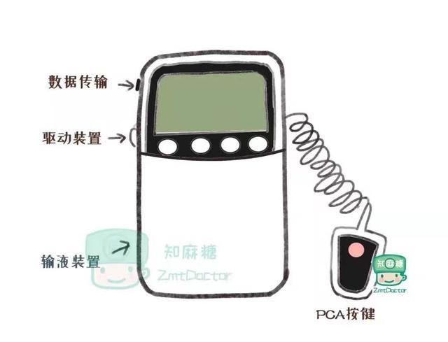 随着患者对舒适化医疗的需求增加,镇痛泵的使用不断增加.