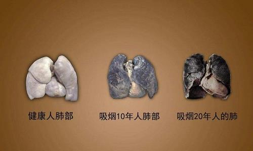 吸烟的人大多寿命都不长?英国专家研究50年,得出了一个结论