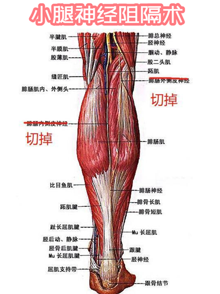 小腿神经阻断术瘦真不靠谱瘦小腿有没有一劳永逸的方法