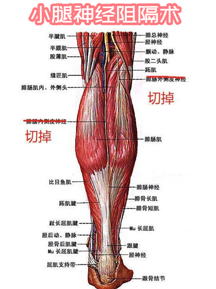 小腿神经阻断术瘦真不靠谱!瘦小腿有没有一劳永逸的方法?