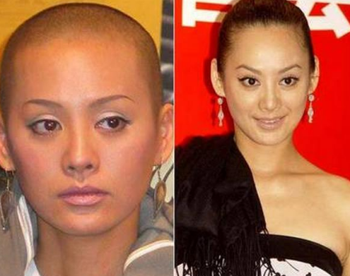 谁说光头不好看?当这些明星没了头发后,才知啥叫颜值天花板