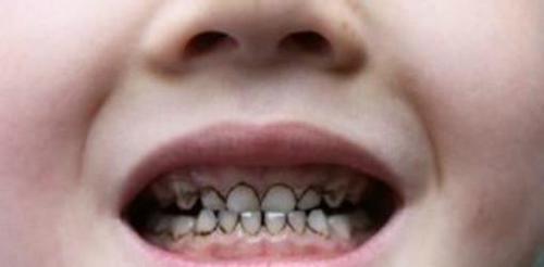 梦境解析，梦见满口牙齿脱落，新旧更替的深层含义