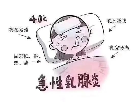 急性乳腺炎的中西医辩证及治疗方法