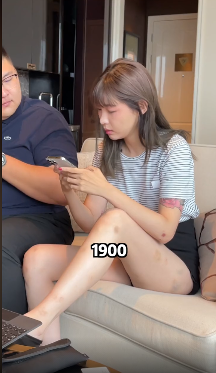 痞幼穿短裙秀美腿,青一块紫一块被质疑遭家暴,回应:我身体不太好,体质