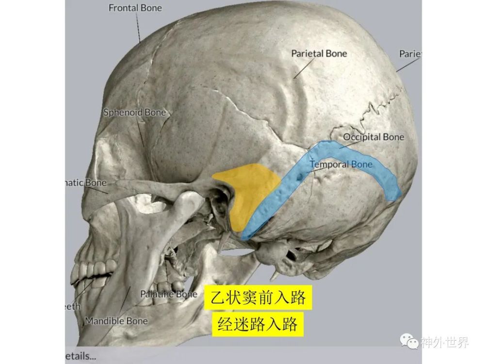 后方经岩骨入路-乙状窦前入路——显微,内镜解剖专栏