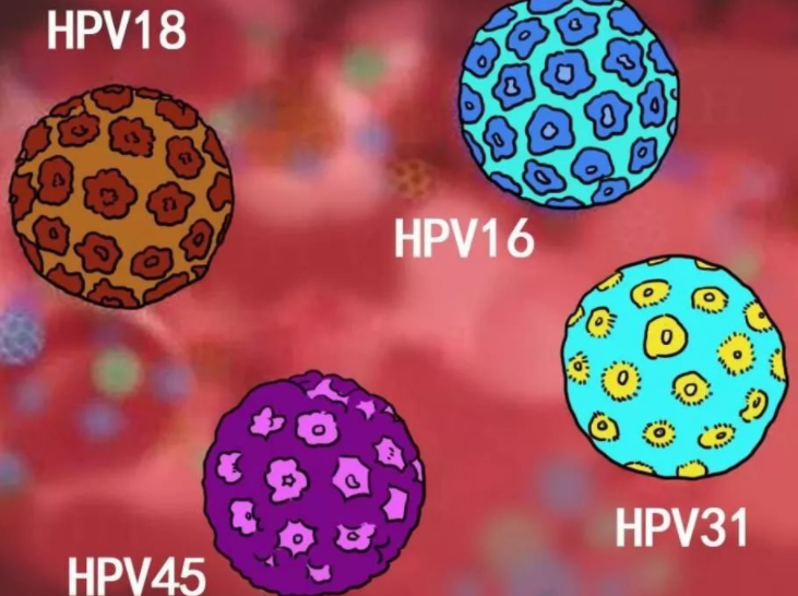 宫颈有hpv,下腹先知,下腹出现3个情况,或是hpv已经"临门"