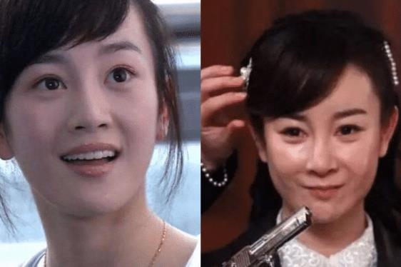 5位整容失败的女星第2位堪比毁容最后一位直接成大妈