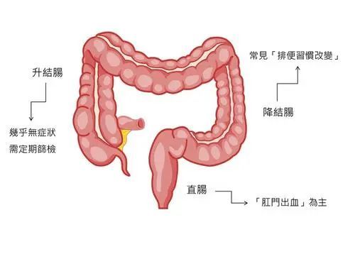 肛门长小肉疙瘩是怎么回事?