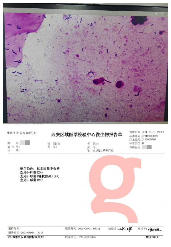 在其他医院做痰培养48小时,结果显示为正常菌群生长,但治疗一周仍不见