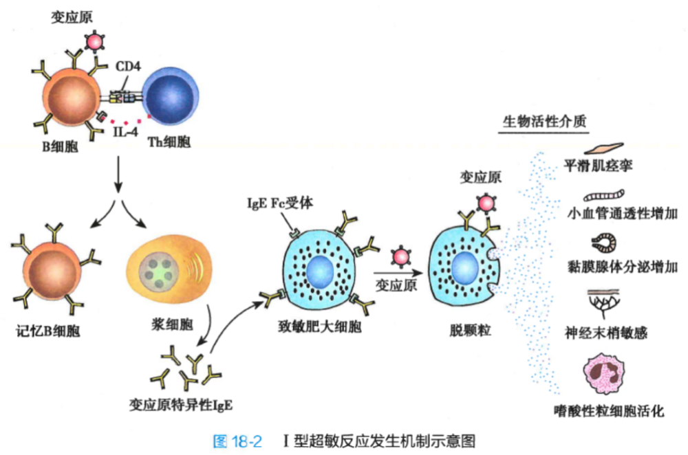 i型超敏反应的特点是:由ige介导,肥大细胞,嗜碱性粒细胞,嗜酸性粒细胞