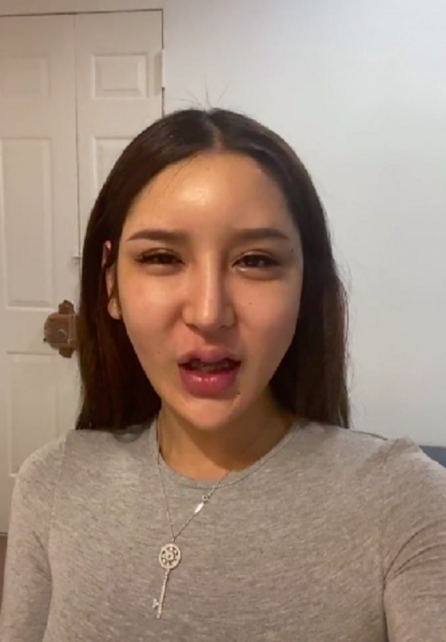 知名网红痴迷整容,花费百万最终整容失败,她表示:我永远最美|整容|网