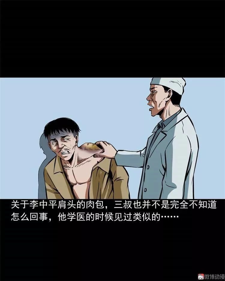 民间诡异漫画《怪病》,肩膀上长出可怕的人面疽!