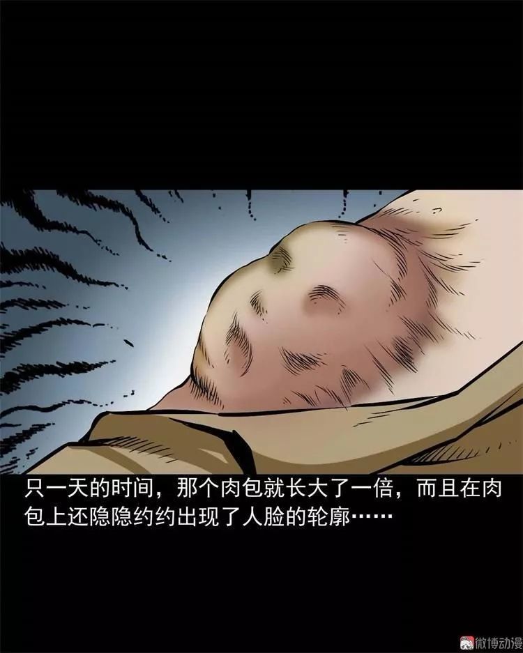 民间诡异漫画《怪病》,肩膀上长出可怕的人面疽!