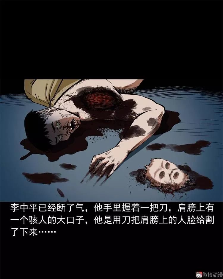 民间诡异漫画《怪病》,肩膀上长出可怕的人面疽!