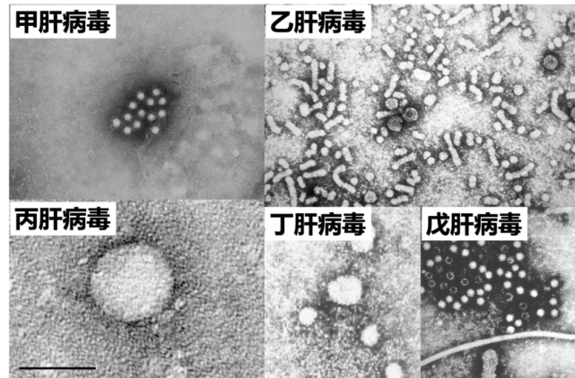 从屈服到征服:人类与肝炎病毒的千年激斗