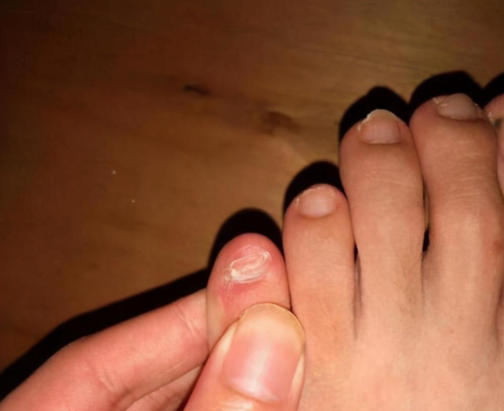 小脚趾甲分成两半的人,才是纯正的汉族人?作为华夏儿女应当了解