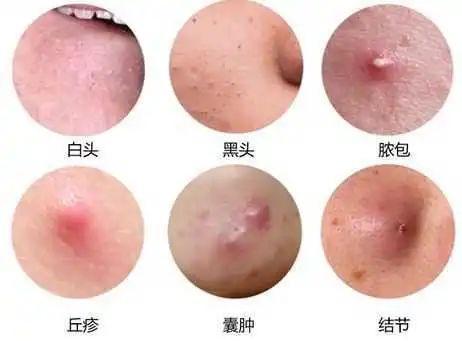 长期戴口罩皮肤发红发痒过敏怎么办药师的自用秘方送给你