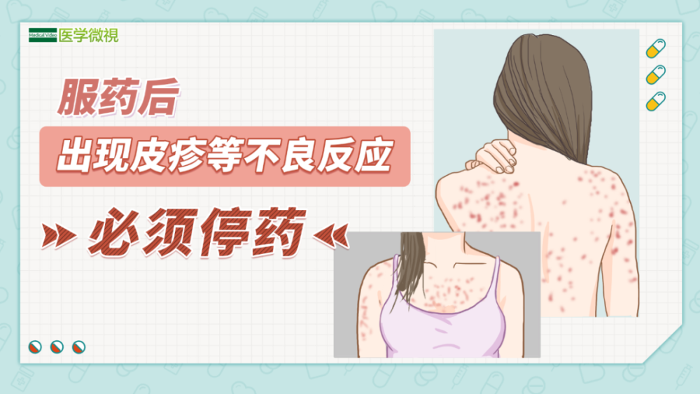 奥美拉唑是作用于消化道的药物,最常见的不良反应就是一些 消化道