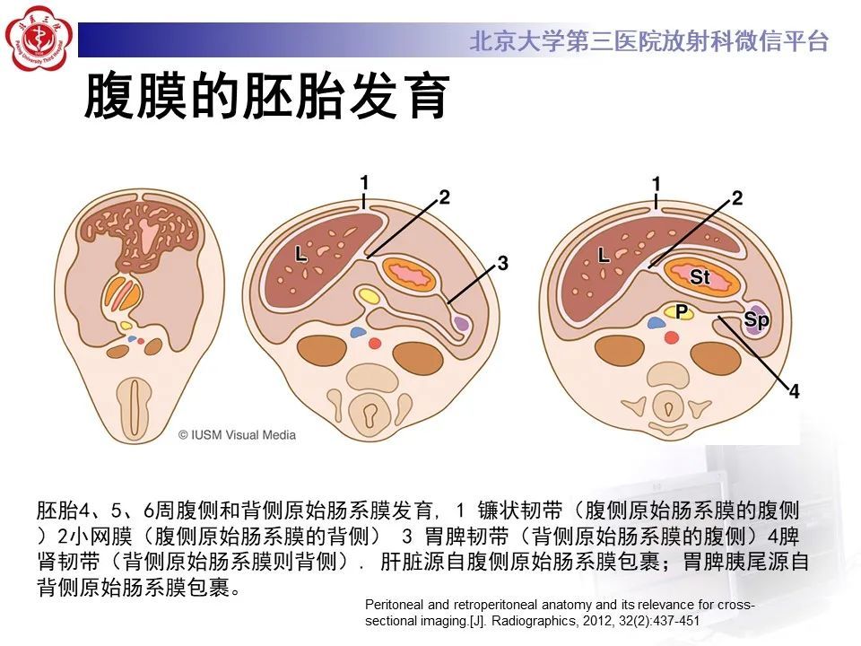 腹膜及腹膜后间隙的解剖内附影像图谱