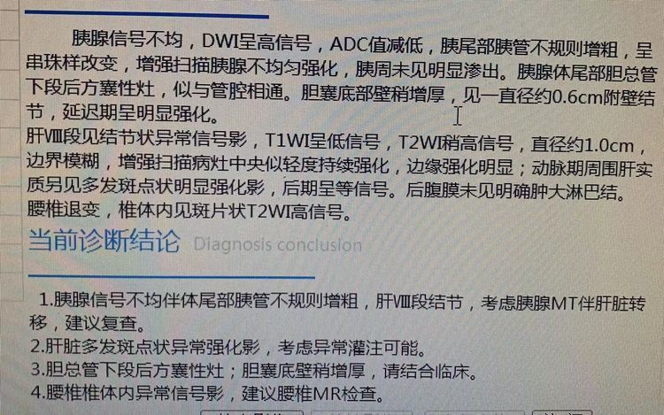 就是腹部增强ct发现了大问题,腹部增强ct高度怀疑这个病人是胰腺癌肝