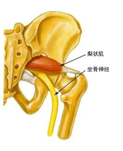 梨状肌综合征诊断分析与手法治疗