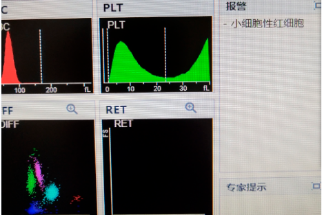 血细胞直方图和散点图如图所示:1带着困惑,一步一步的找原因:血常规