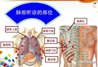 拍背排痰 6 大禁忌,你知道吗?_腾讯新闻