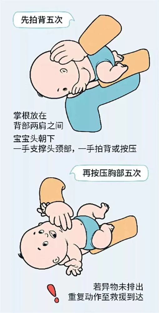 异物卡喉咋办?市中心医院专家教你海姆立克急救_腾讯新闻