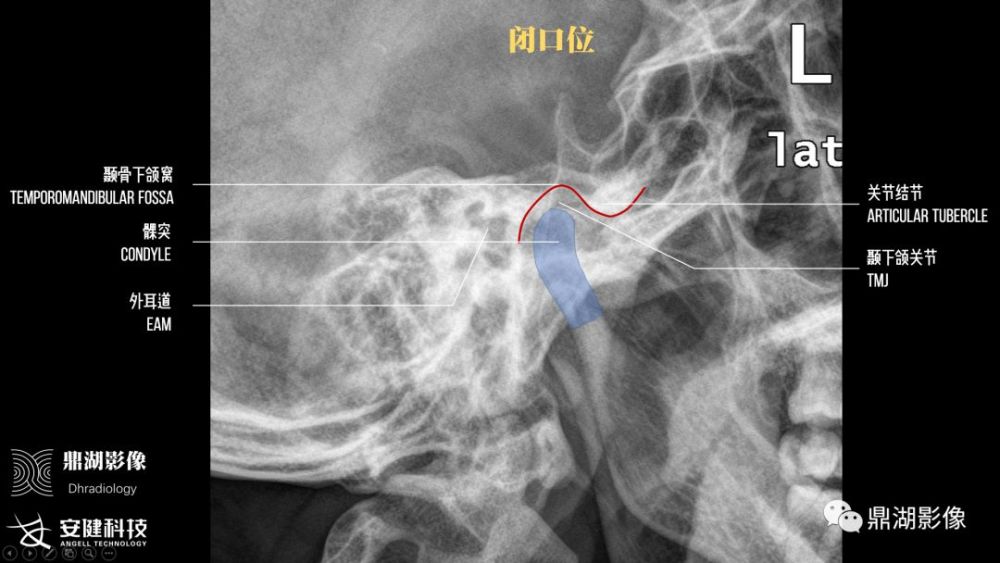 x线高清图谱精致颞下颌关节解剖