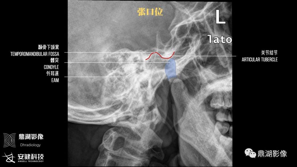 x线高清图谱精致颞下颌关节解剖