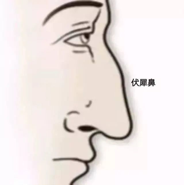 5.胡羊鼻胡羊鼻的特征是鼻头大且圆,但左右大小匀称,鼻翼不大.