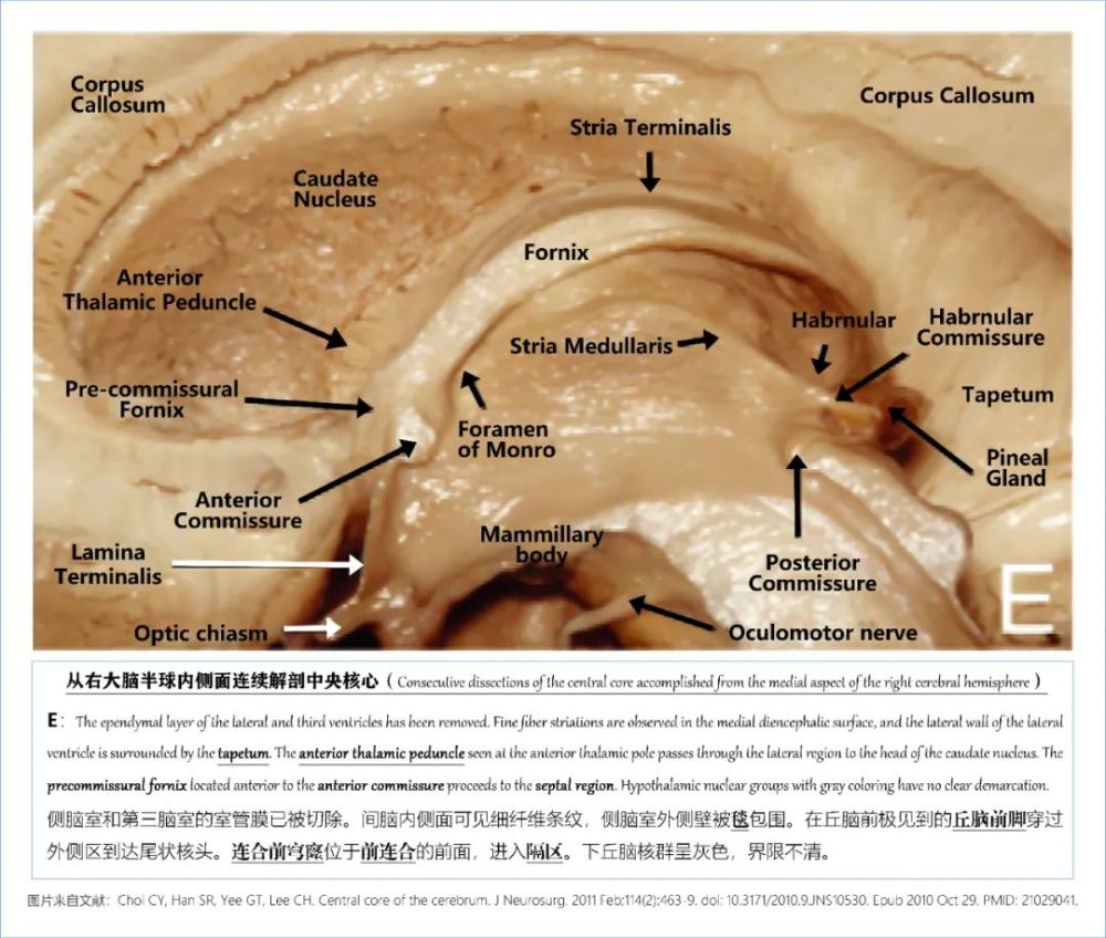 学习笔记|大脑深部解剖之解剖层次篇