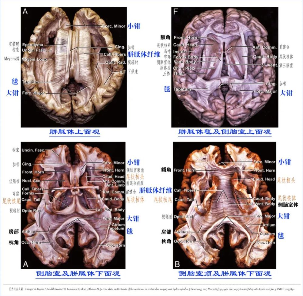学习笔记|大脑深部解剖之解剖层次篇