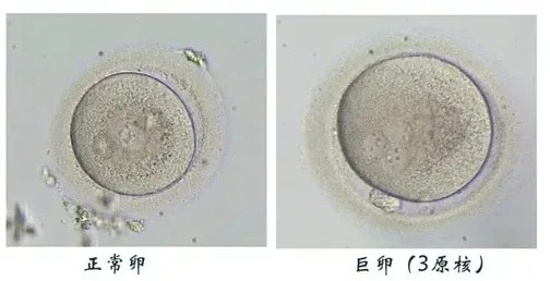 卵泡也看颜值那究竟最美卵子都长什么样呢