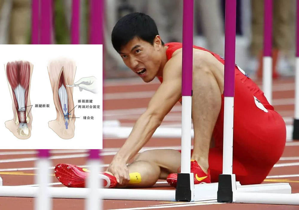 刘翔因跟腱断裂退出奥运比赛