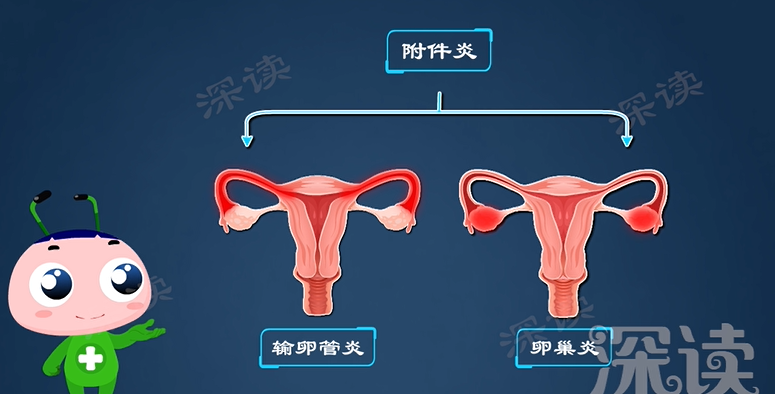 输卵管炎走起!