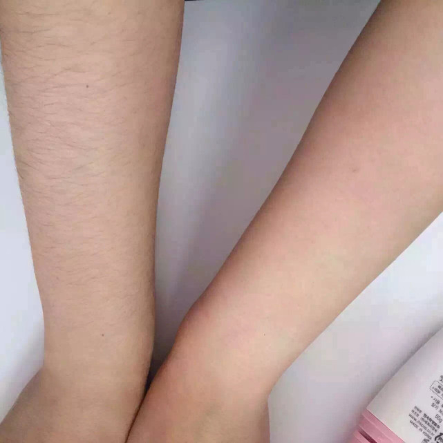 女性体毛浓密还是稀疏,有什么区别?除了遗传,这个原因