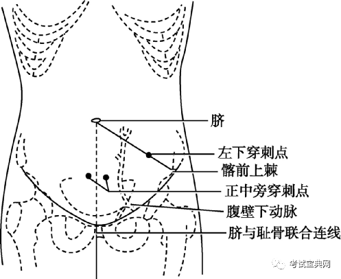 急性胆囊炎 (三)内镜 (四)诊断性腹腔穿刺