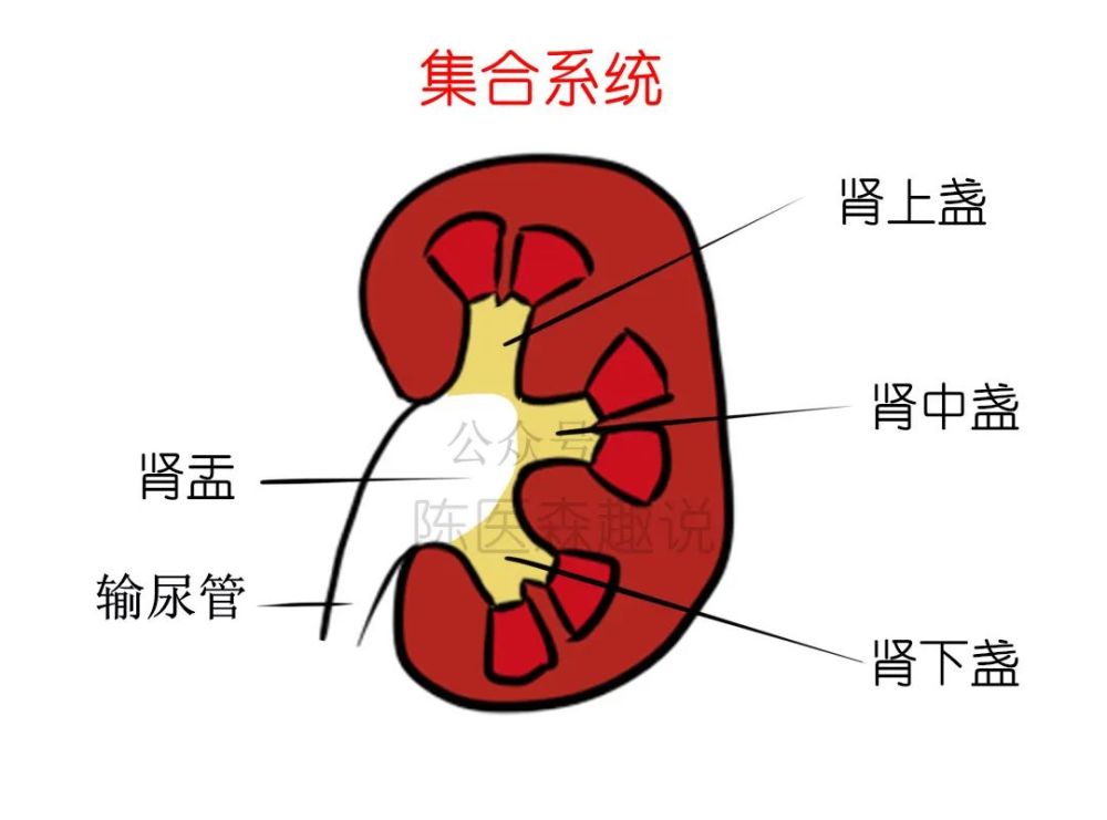 肾下盏的结石很难排出?一定要试试这个方法