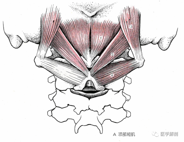 头后大直肌(ab2,rectus capitis posterior major)起于第 2 颈椎的棘