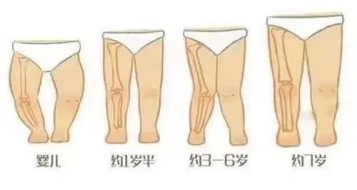 婴儿腿型发展规律