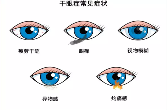 眼睛疲劳干涩,谁惹的祸?