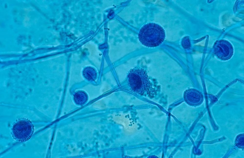 羊肚菌母种分离—孢子分离法