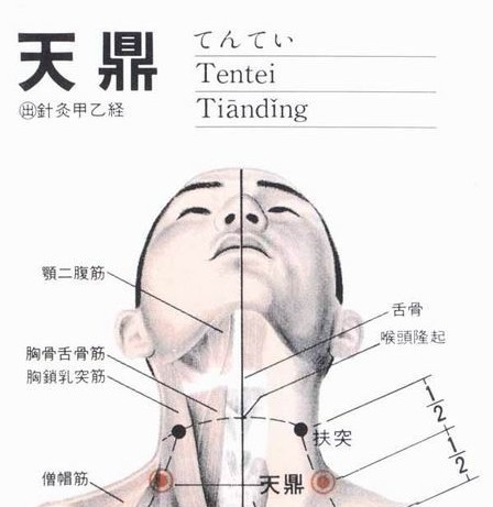 按摩方法:取坐位,按摩者双手中指或拇指点按两侧天鼎穴1 分钟,以不