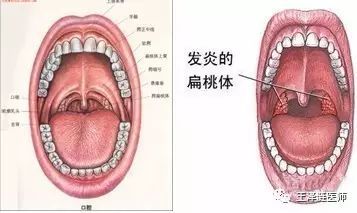 暑假尽量少给宝宝们吃这些东西,容易导致喉咙痛及发烧