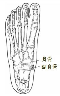 副足舟骨别忽略,分型要牢牢记住!
