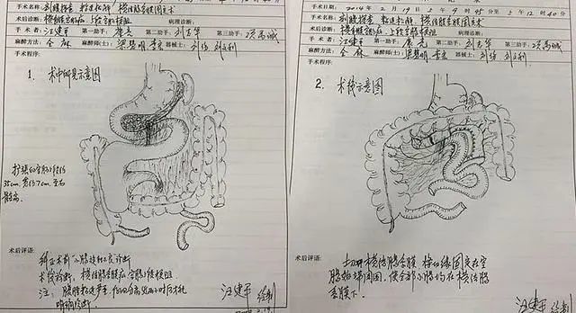 超赞手绘"手术图谱"!六旬老院长圈粉无数